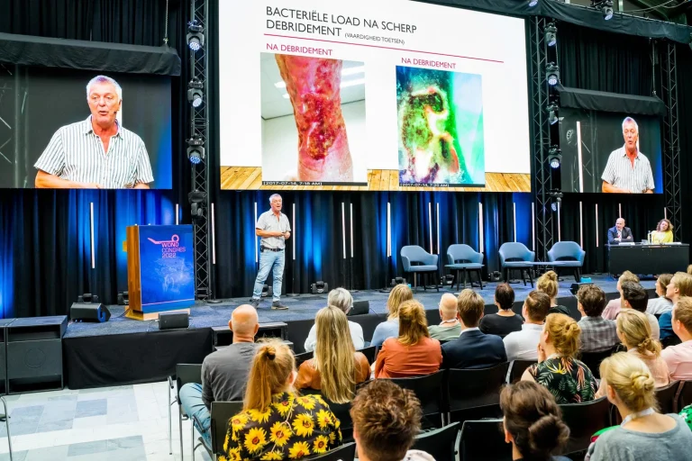 Sfeerimpressie Wondcongres 2022